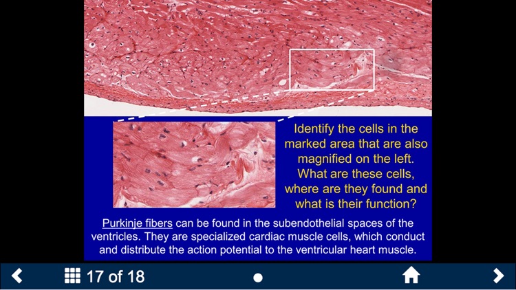 Histology - Cardiovascular and Lymphatic System screenshot-3