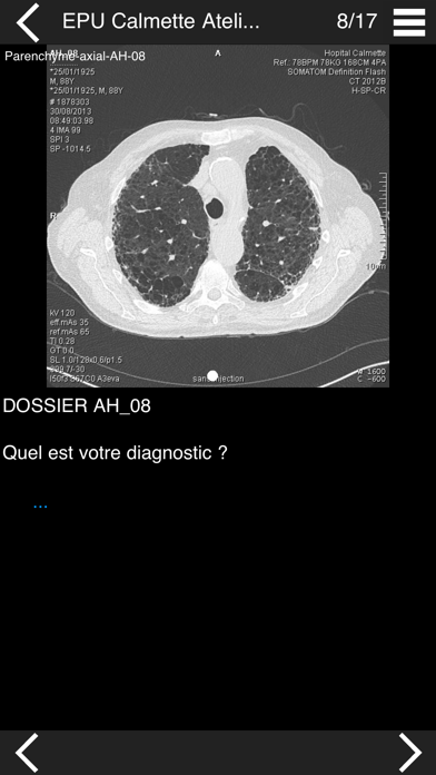 Screenshot #1 pour Cours TDM multicoupe du thorax