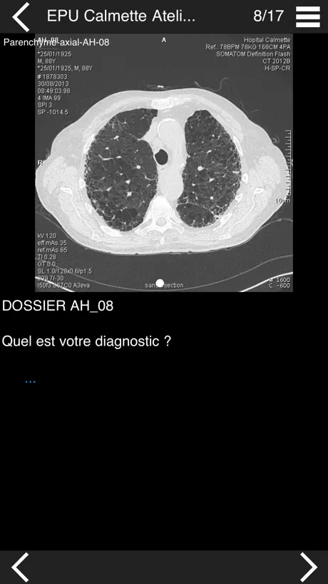 Cours TDM multicoupe du thorax