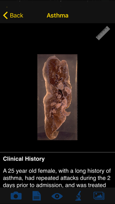 Screenshot #3 pour Images Of Disease