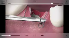 the oral surgery suture trainer iphone capturas de pantalla 2
