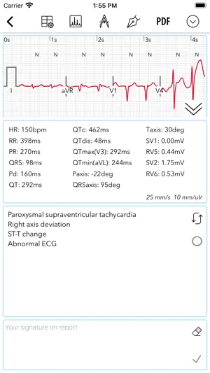 ECG Pro for Doctors screenshot 4