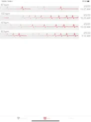 kardiograph-herzfrequenzmesser ipad bildschirmfoto 4
