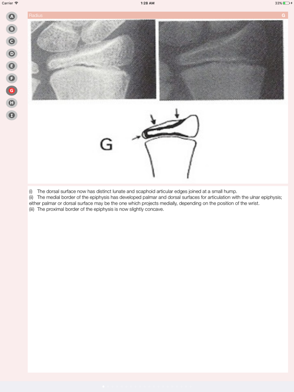 Screenshot #5 pour Bone Age