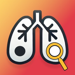 Lung Nodule Follow-up Guide