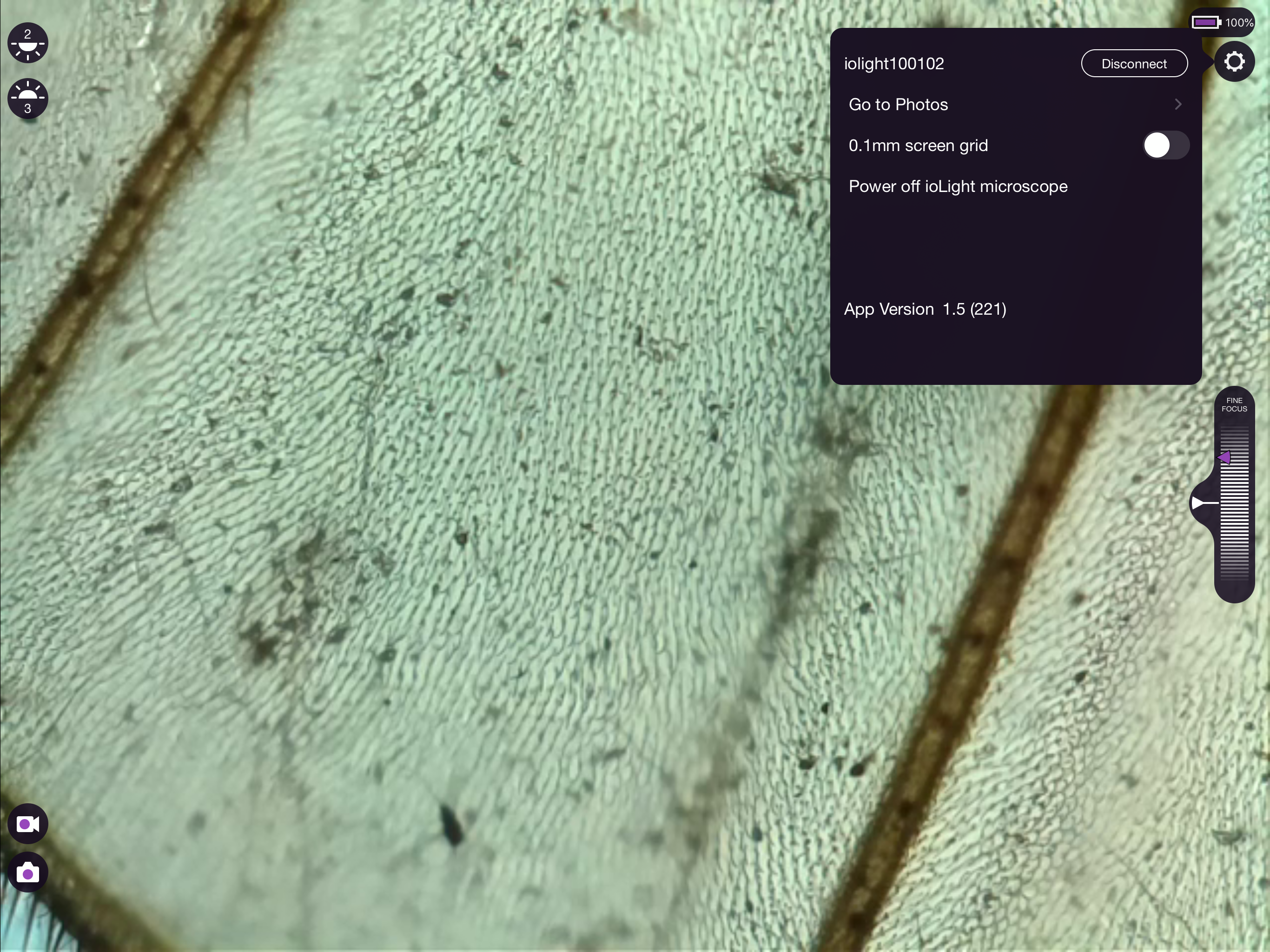ioLight Microscope