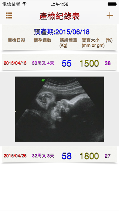 Screenshot #2 pour 孕app