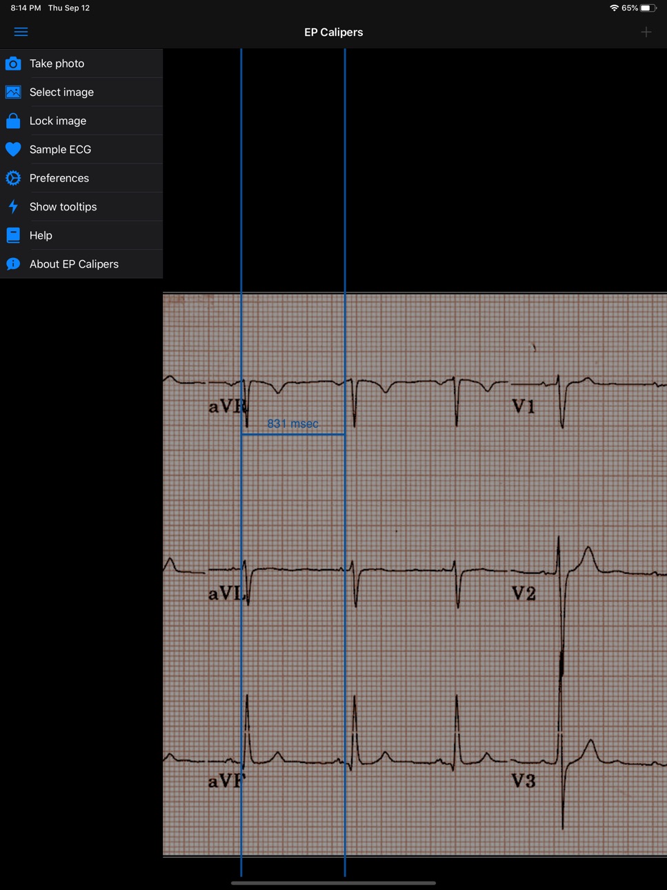 iPad screenshot