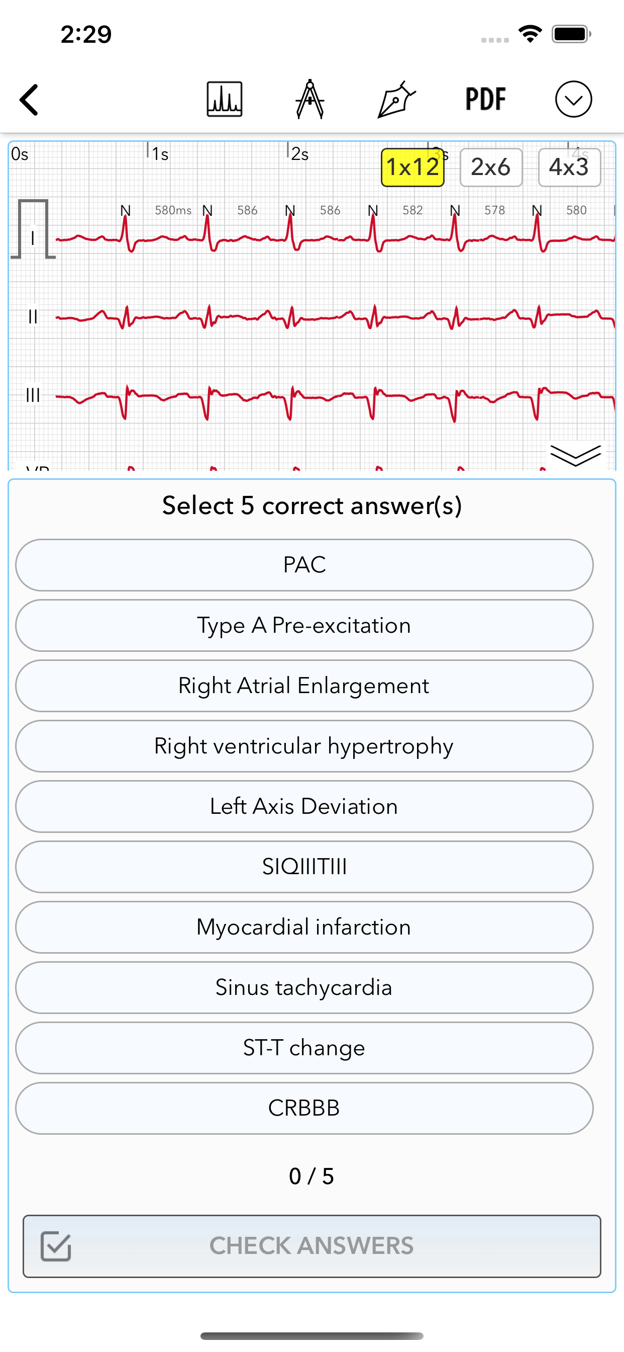 ECG Pro | Road to Mastery screenshot 6