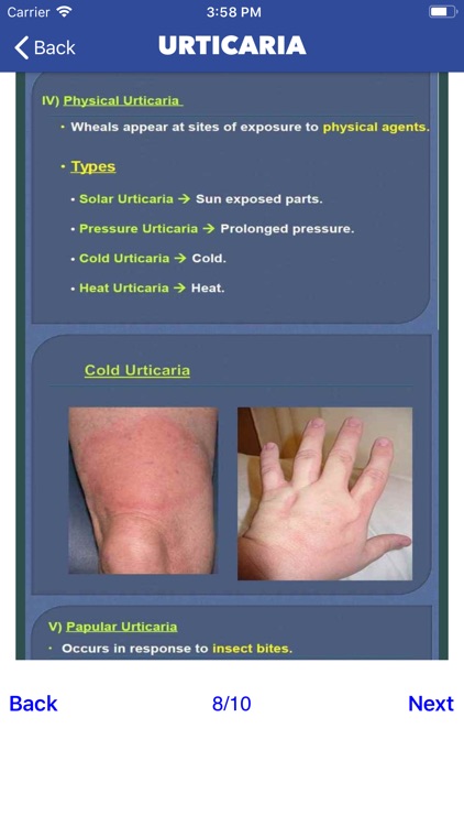 Skin Infections and Treatments