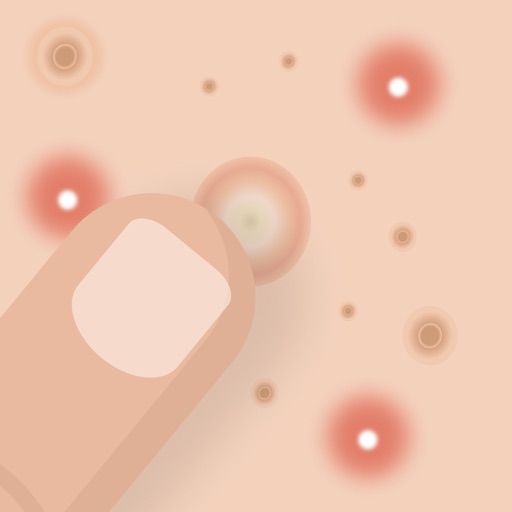Blemish, Acne, Pimple remover