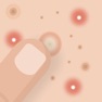 Get Blemish, Acne, Pimple remover for iOS, iPhone, iPad Aso Report