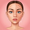 Acne Remover: Clear Skin icon