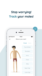 MoleCare - Skin Health Tracker screenshot