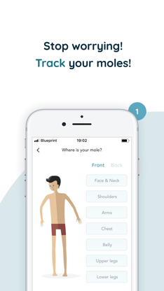 MoleCare - Skin Health Tracker screenshot 1