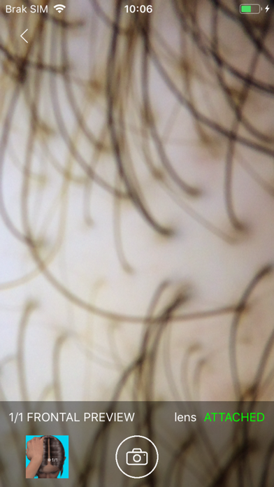 Screenshot #3 pour TrichoLAB snApp