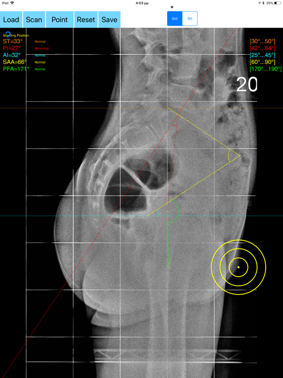 Screenshot #6 pour SpinopelvicMobilityApp