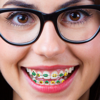 Braces on teeth – stickers ai