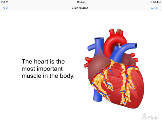 Screenshot #6 pour X-Plain