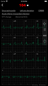 ECG Pro | Road to Mastery screenshot