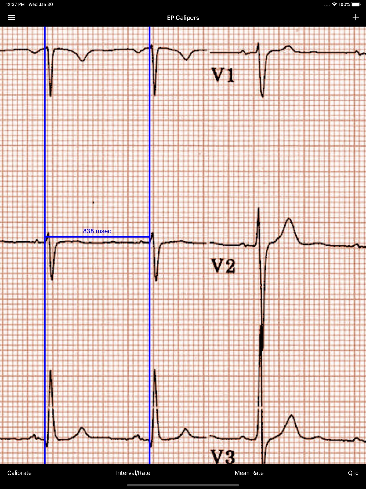 EP Calipers ipad screenshot 1