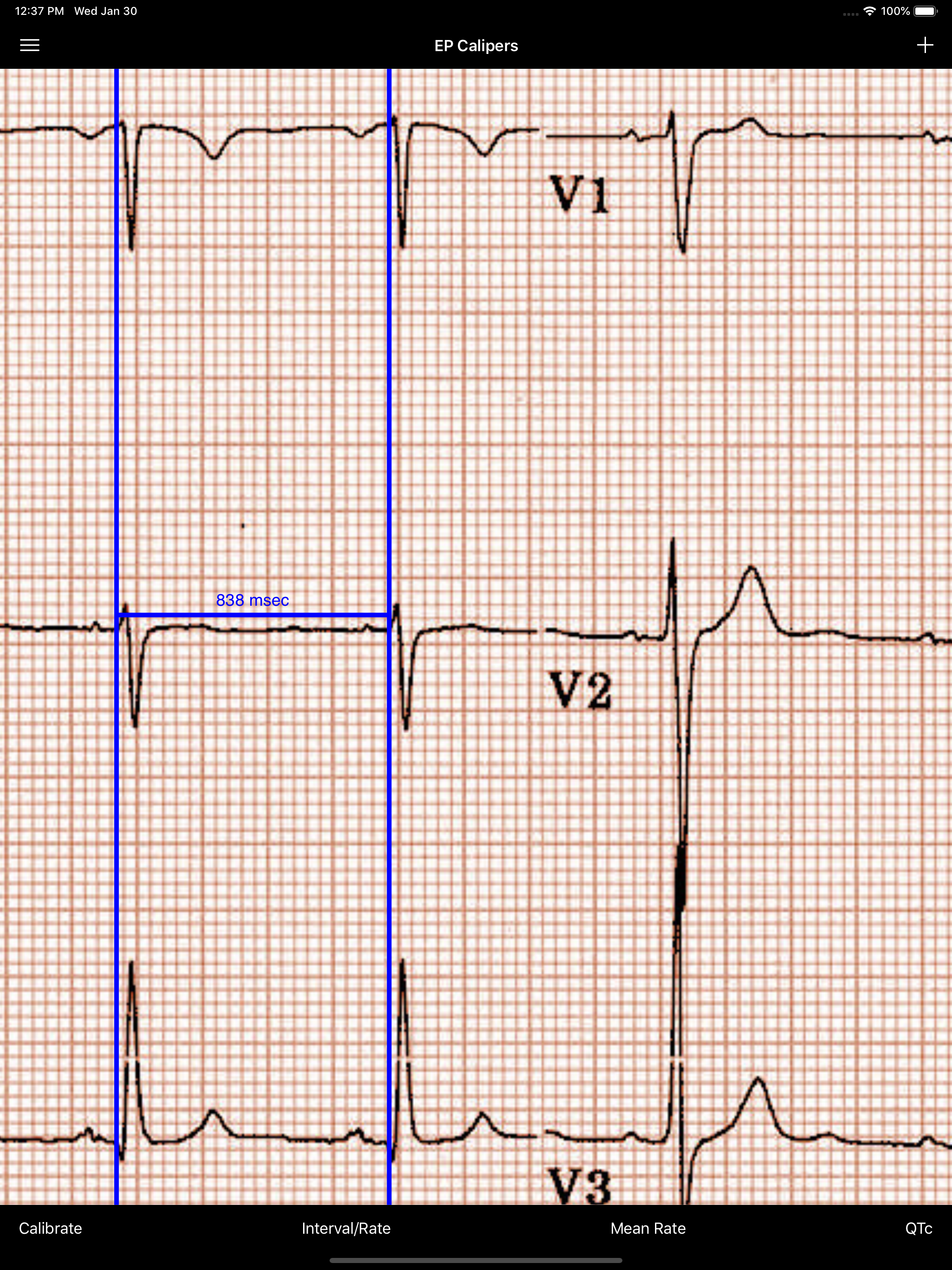 EP Calipers screenshot 8