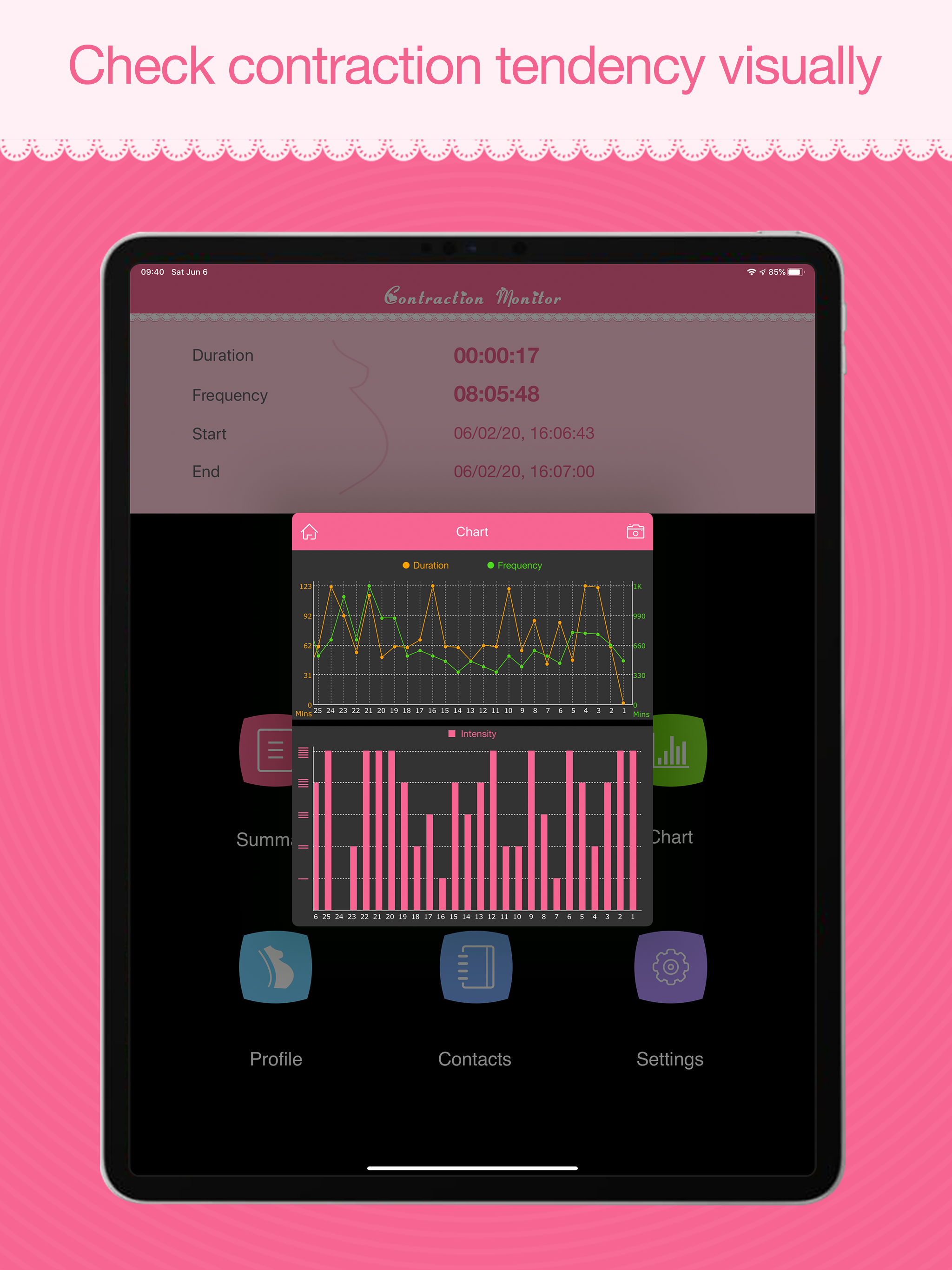 Contraction Monitor
