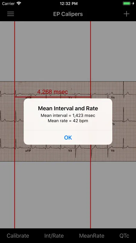 EP Calipers screenshot 5 of 7