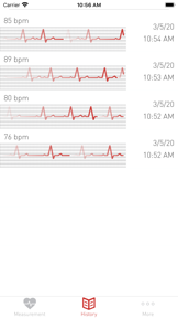 Cardiograph Heart Rate Monitor screenshot