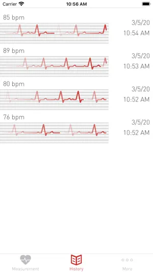 Cardiograph Heart Rate Monitor screenshot 4