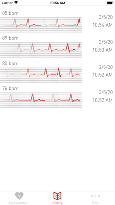 Cardiograph Heart Rate Monitor screenshot 4