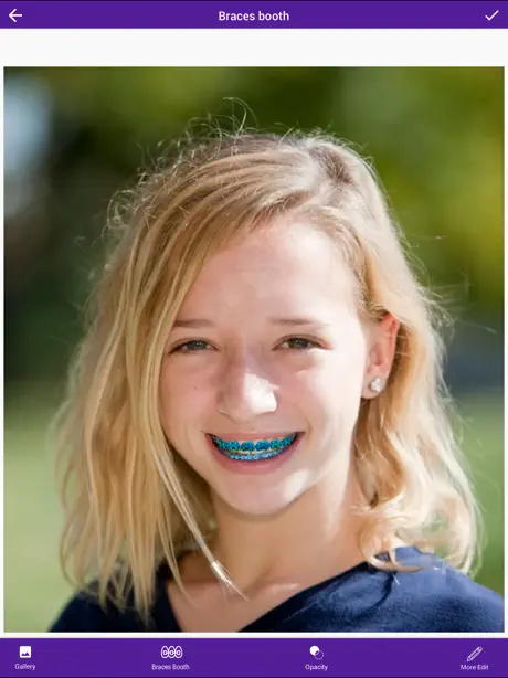 AI Braces Camera Photo Editor