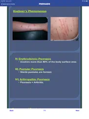 skin infections and treatments ipad resimleri 3