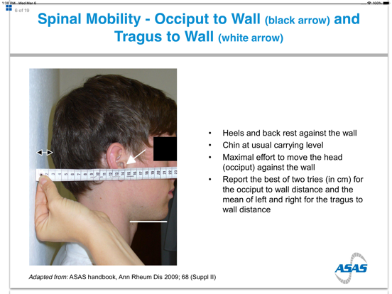 ASAS App iPad screenshot 7 - Medical app