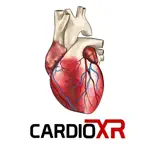 CardioXR App Cancel