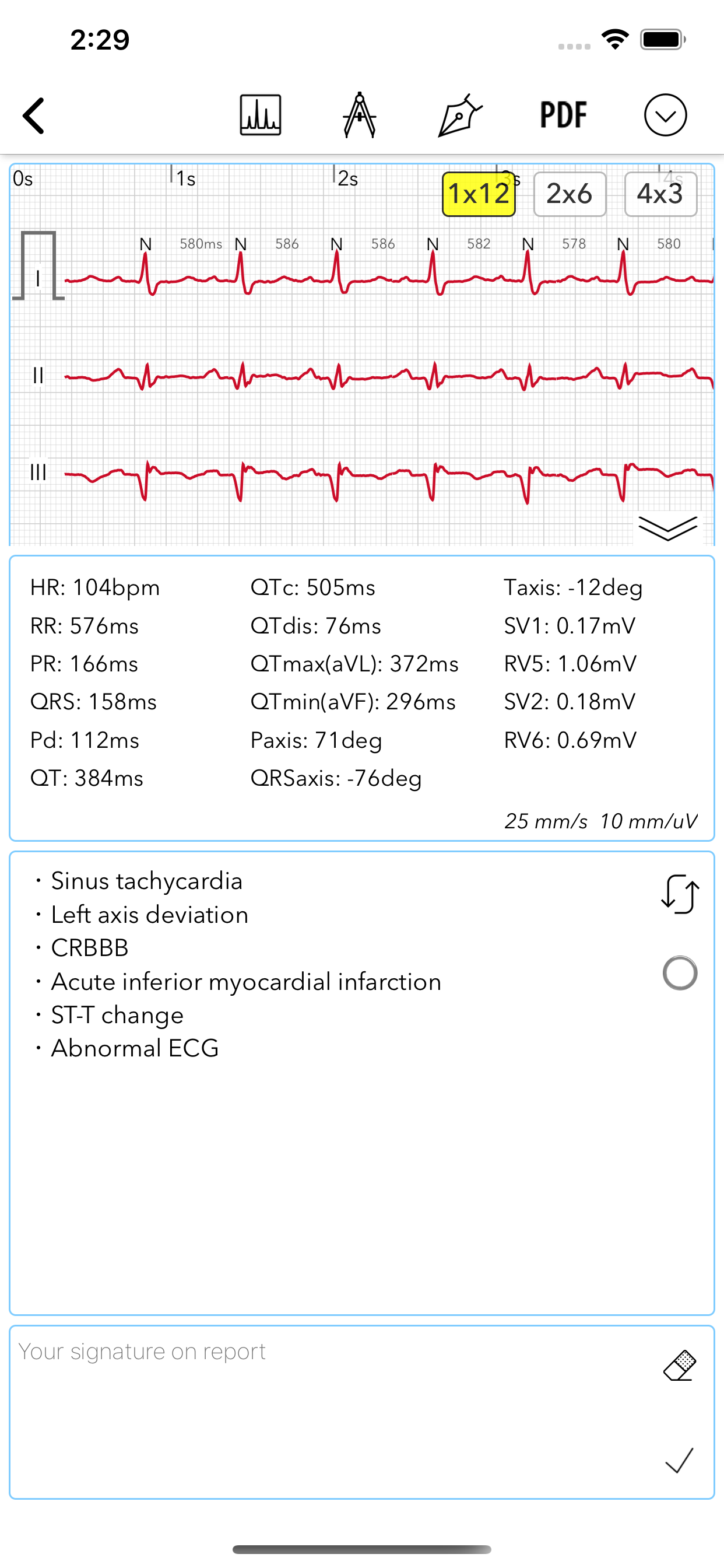 ECG Pro | Road to Mastery screenshot 4