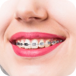 AI Braces Camera Photo Editor