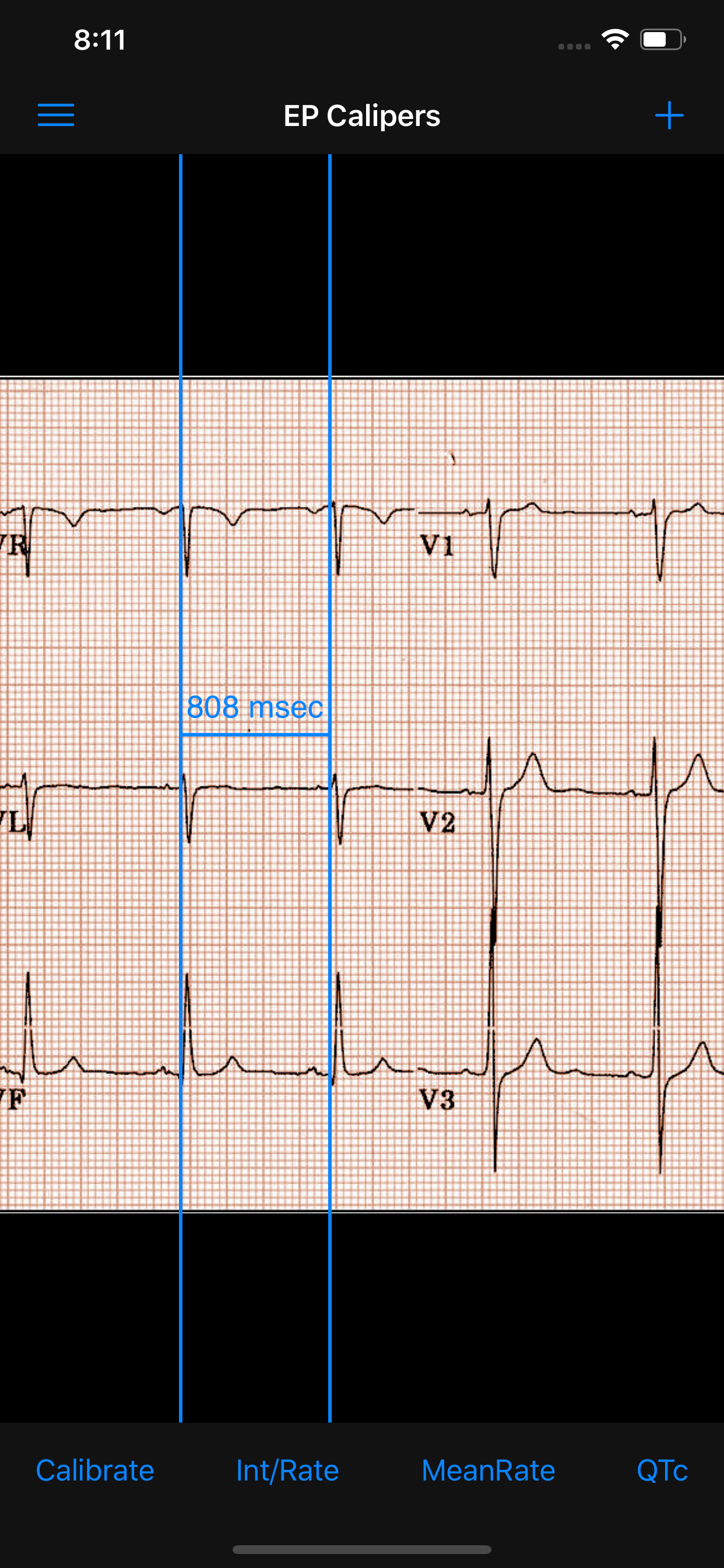 EP Calipers screenshot 7