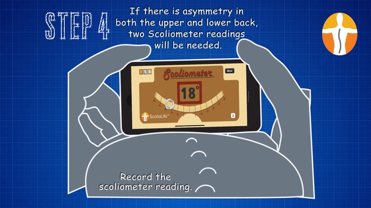 Scoliometer screenshot-8