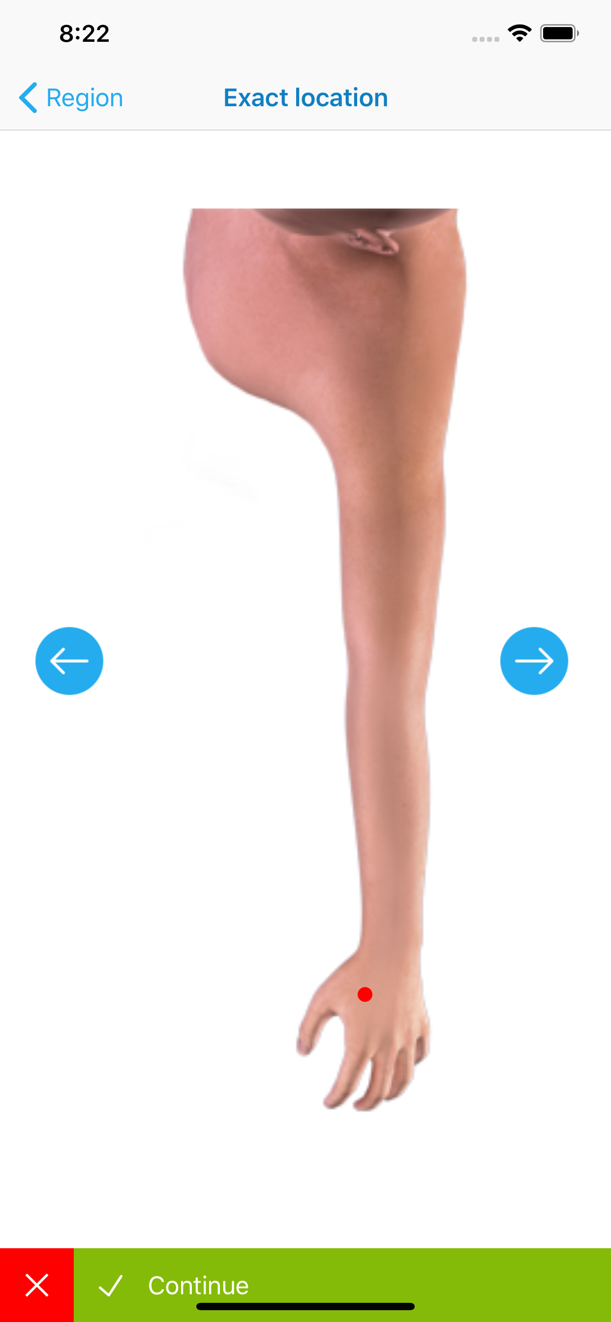 Dermtest Camera