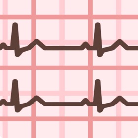 ECG Guide Ultimate