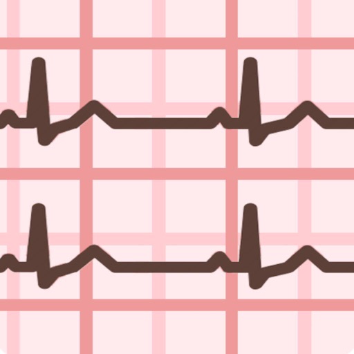 ECG Guide Ultimate