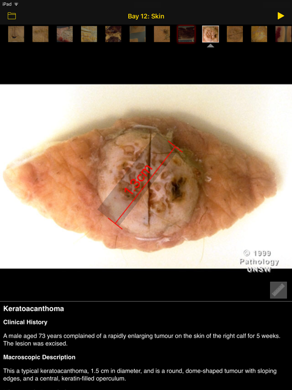 Images Of Disease iPad screenshot