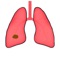 A collection of staging tools for lung cancer and mesothelioma, with detailed decision aids for tumour, nodal and metastasis staging