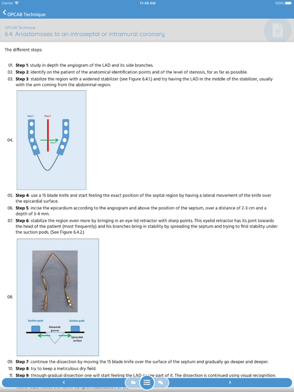 CABG - OPCAB Surgery Training iPad screenshot
