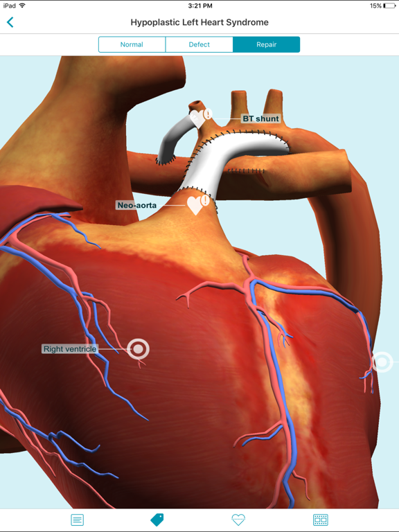 Heartpedia iPad screenshot 5 - Medical app
