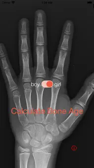 Bone Age iphone resimleri 1