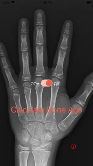 Bone Age screenshot 1