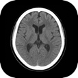 Dicom-MedResearch Viewer