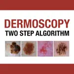 Dermoscopy Two Step Algorithm App Support